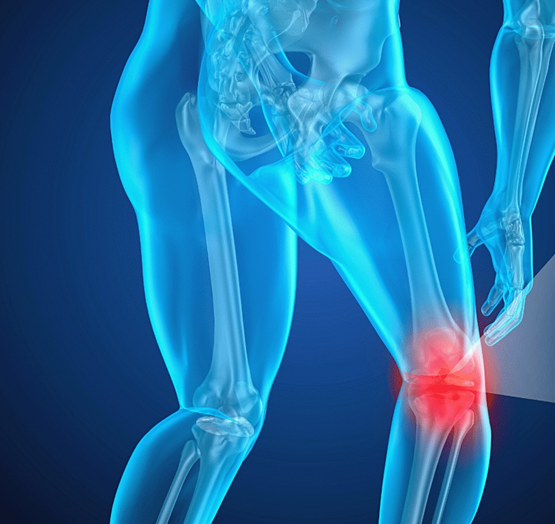 Curso EAD de Osteotomias ao Redor do Joelho - Maio 2026